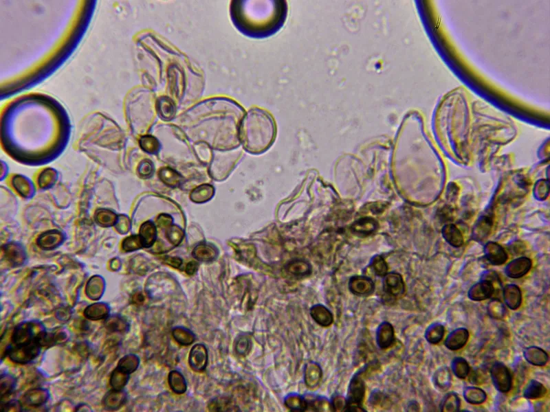 Agaricus impudicus 10 - Queilocistidios 2